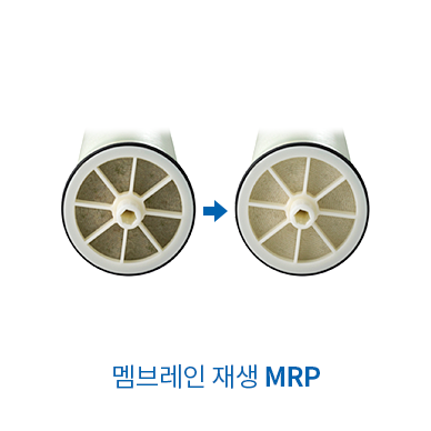 멤브레인 재생 MRP